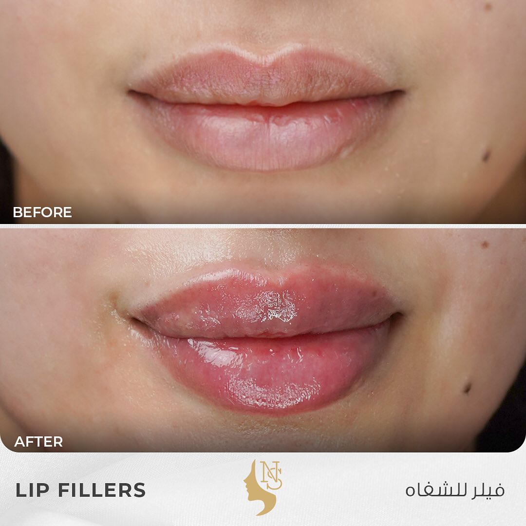 436328902_17998534835574417_4115092505247005889_n