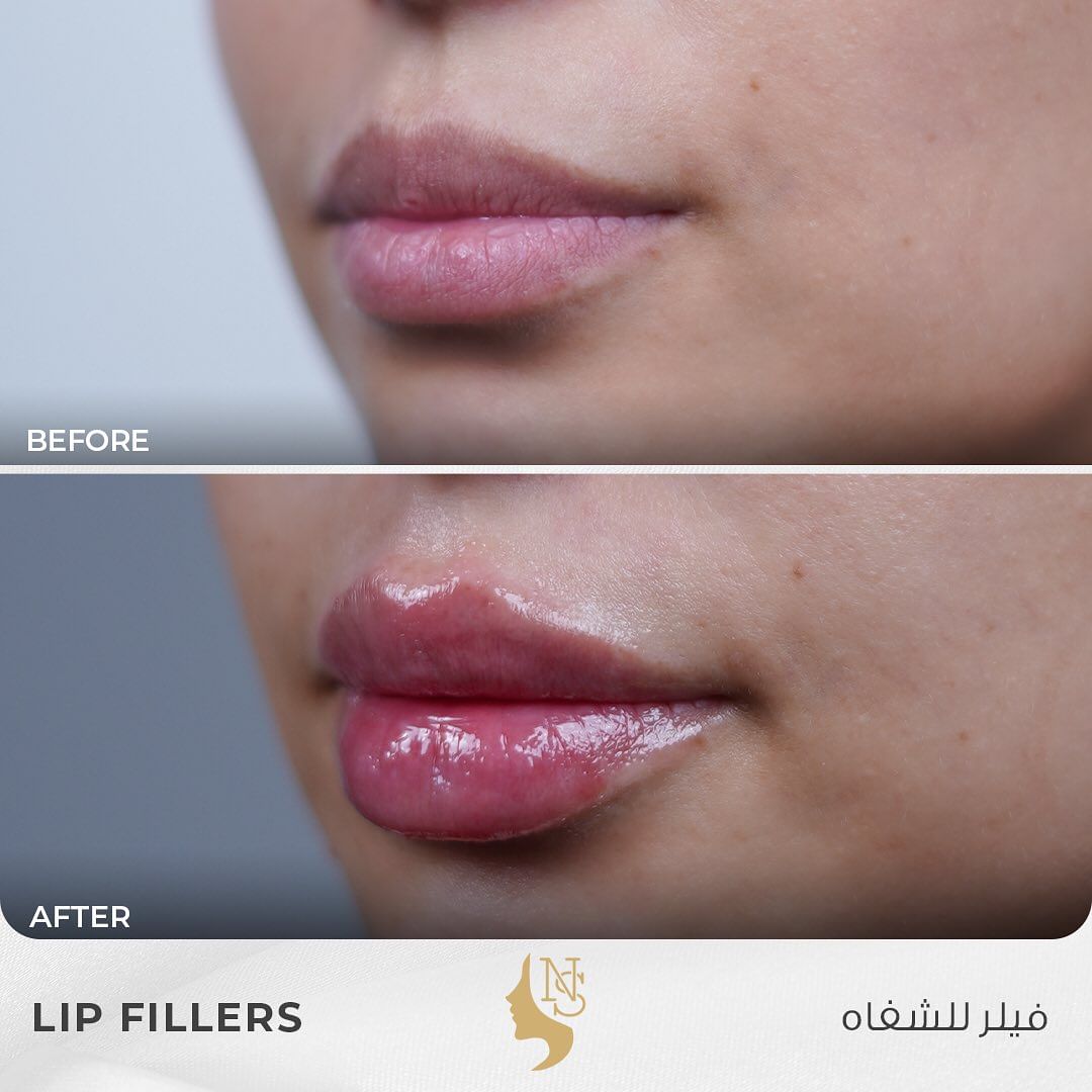 437179507_17999517002574417_7639321221857590452_n