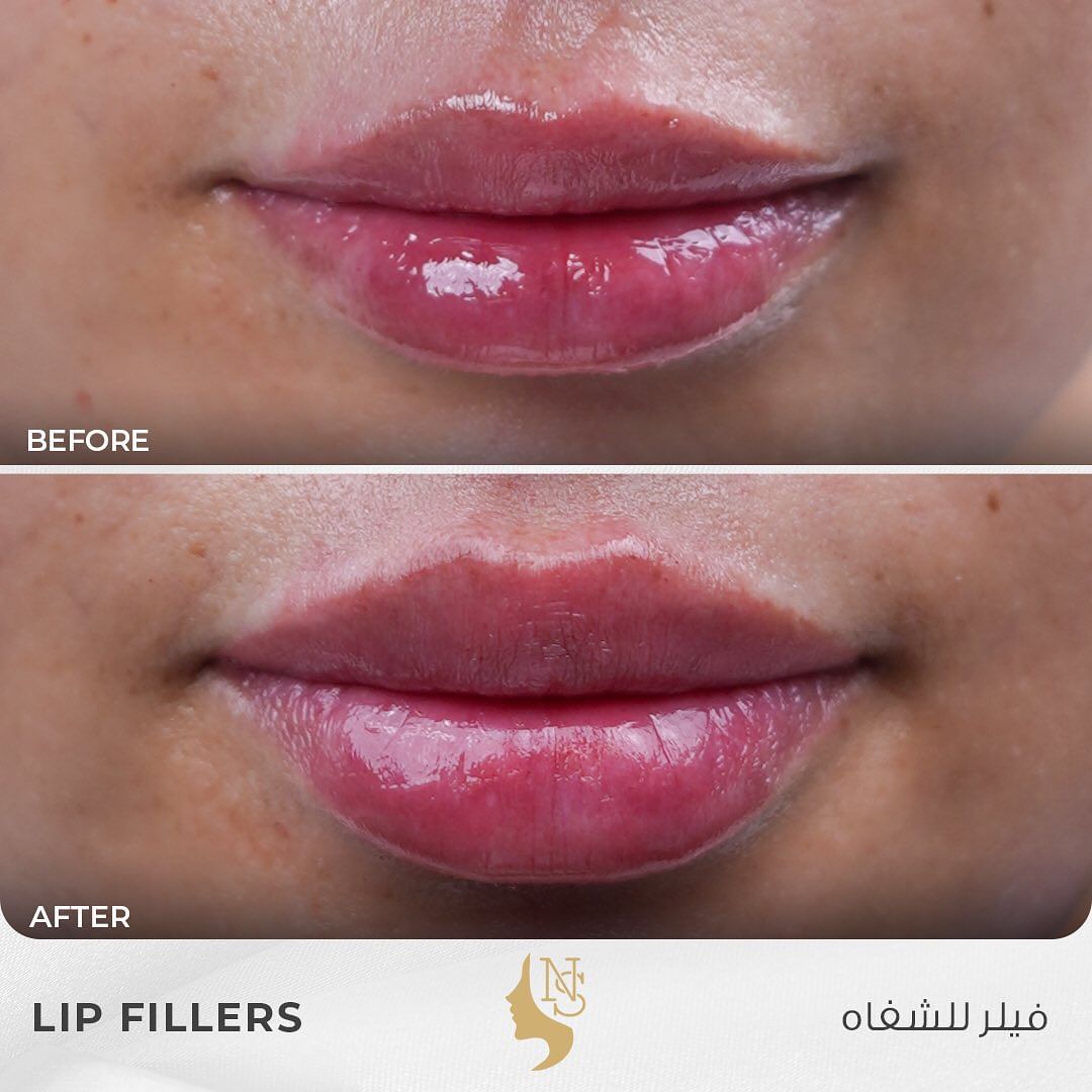 440957550_18000696317574417_7771453755952545093_n